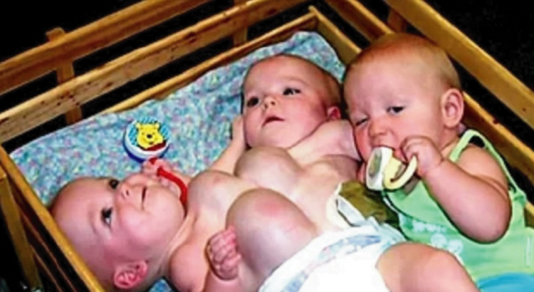 Prieš 18 metų gimė unikaliausios trynukės pasaulyje - dvi iš jų buvo suaugusios. Štai kaip sesės gyvena dabar