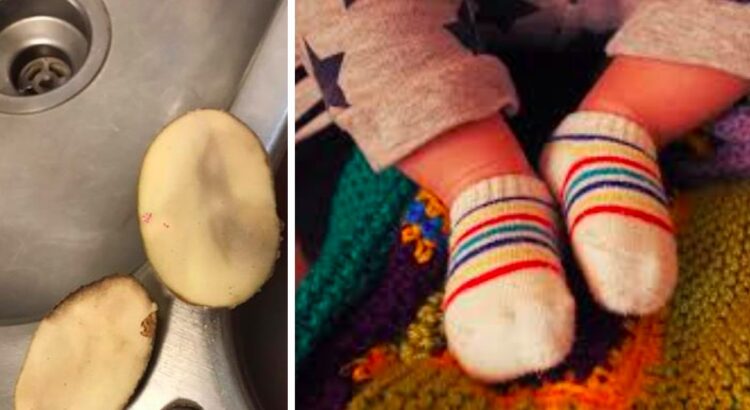Mama į karščiuojančio kūdikio kojines įdėjo bulvių griežinėlius. Kitą dieną nustebusi ji pasidalino nuotraukomis internete