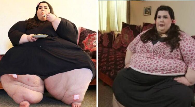 272 kilogramus svėrusi mergina pakeitė savo gyvenimą ir atsikratė 180 kg. Štai kaip ji atrodo šiandien