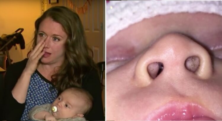 Mama pastebėjo juodus taškelius savo mažylio nosyje. Kai ji sužinojo jų priežastį, nusprendė įspėti ir kitus