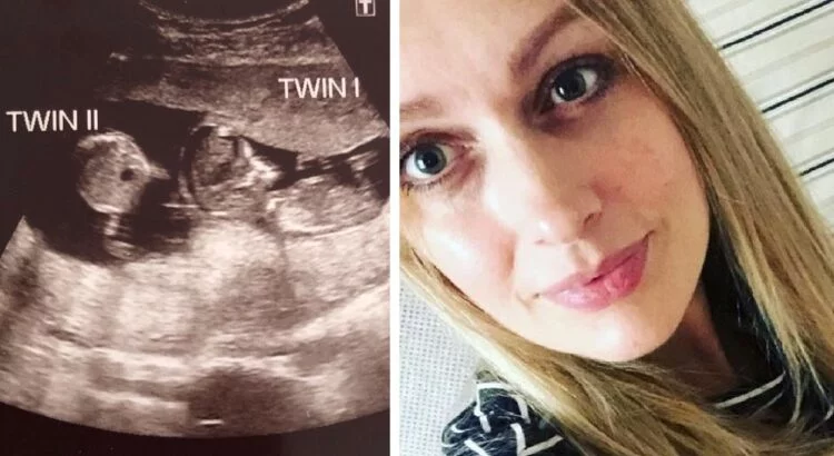 Gydytojai palygino nėščiosios pirmojo ir antrojo echoskopinio tyrimo nuotraukas ir patyrė šoką pamatę tai, ko neturėjo pamatyti. Netrukus moteriai buvo atskleista nuostabi žinia