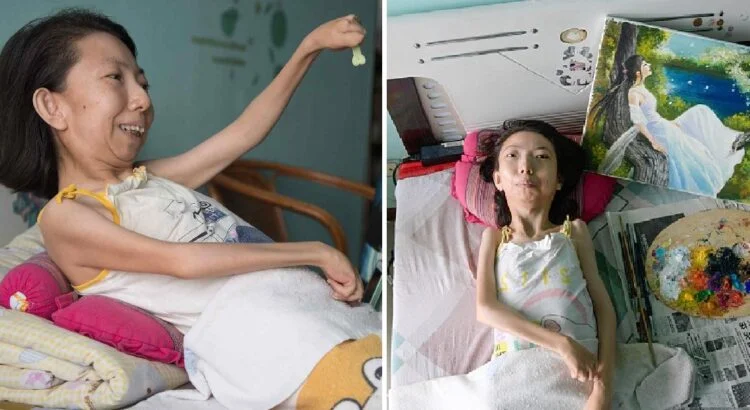 Ši moteris pastaruosius 36 metus praleido lovoje dėl viso kūno paralyžiaus. Tačiau šiandien ji stebina milijonus žmonių dėl to, ką sugeba daryti beveik nejudėdama