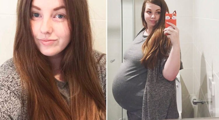 Ketvirtą kartą nėščia moteris jautė, kad su jos pilvu kažkas ne taip, todėl nuvyko pas gydytoją. Čia ji išgirdo pribloškiančią žinią