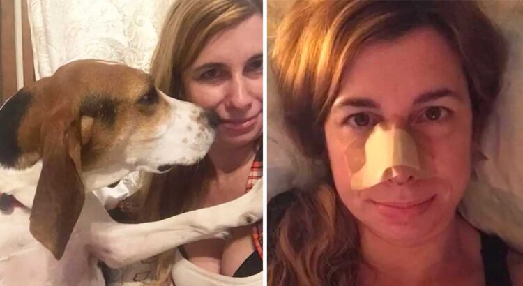 Moteris niekaip nesuprato, kodėl jos šuo pradėjo nuolat uostyti jos nosį. Galiausiai ji kreipėsi į gydytoją ir nuščiuvo išgirdusi diagnozę