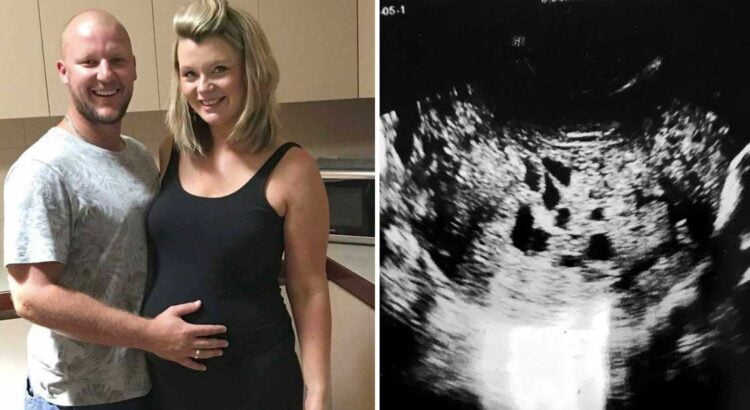 Moteris be galo džiaugėsi nėštumu, tačiau po šešių savaičių nuvyko pasidaryti tyrimo ir sužinojo siaubingą dalyką